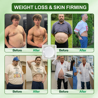 🇨🇦𝑶𝒇𝒇𝒊𝒄𝒊𝒂𝒍 𝑺𝒕𝒐𝒓𝒆 | 𝐀𝐌𝐙𝐊𝐄𝐄𝐏® 𝑴𝒆𝒕𝒂𝒃𝒐𝒍𝒊𝒄 𝑵𝒂𝒏𝒐 𝑴𝒊𝒄𝒓𝒐𝒏𝒆𝒆𝒅𝒍𝒆 𝑷𝒂𝒕𝒄𝒉 (𝐉𝐮𝐬𝐭 𝐨𝐧𝐜𝐞 𝐚 𝐝𝐚𝐲, 𝐯𝐢𝐬𝐢𝐛𝐥𝐞 𝐜𝐡𝐚𝐧𝐠𝐞𝐬 𝐢𝐧 𝟕 𝐝𝐚𝐲𝐬）𝘽𝙚𝙧𝙗𝙚𝙧𝙞𝙣𝙚 + 𝙈𝙤𝙧𝙞𝙣𝙜𝙖 𝙁𝙤𝙧𝙢𝙪𝙡𝙖 ✅ 𝐅𝐨𝐫 𝐨𝐛𝐞𝐬𝐢𝐭𝐲, 𝗟𝗼𝗼𝘀𝗲 𝘀𝗸𝗶𝗻,𝐝𝐢𝐚𝐛𝐞𝐭𝐞𝐬, 𝐬𝐥𝐞𝐞𝐩 𝐚𝐩𝐧𝐞𝐚, 𝐣𝐨𝐢𝐧𝐭 𝐢𝐬𝐬𝐮𝐞𝐬 𝐚𝐧𝐝 𝐦𝐨𝐫𝐞